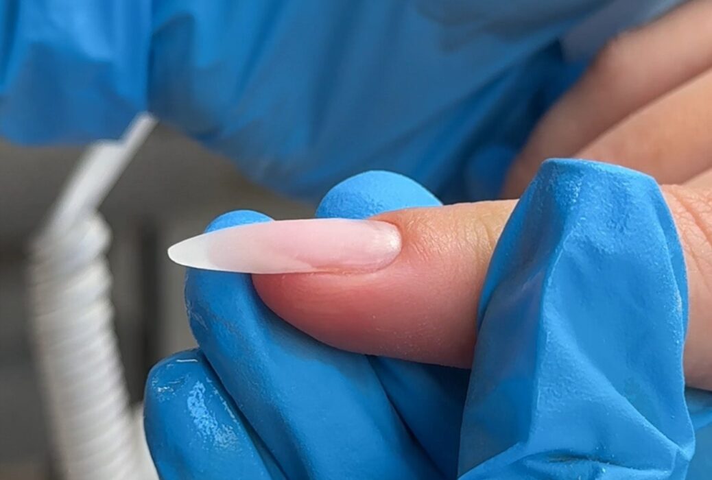 how to correct down-growing nail