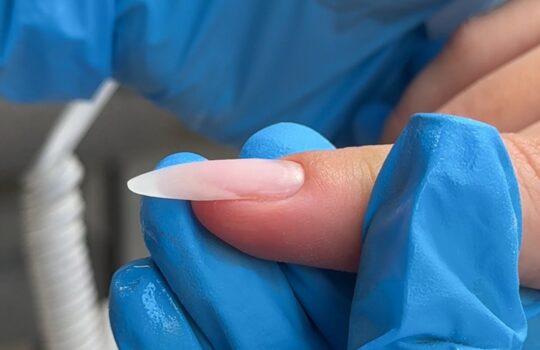 how to correct down-growing nail
