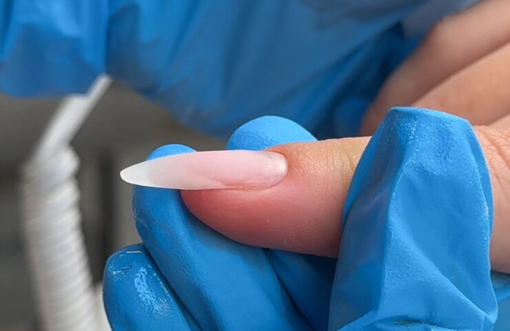 how to correct down-growing nail