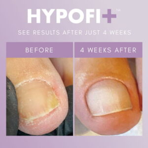 The GelBottle HypoFix Repair Serum